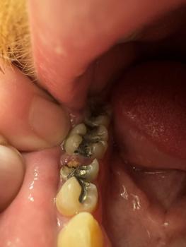 Failing fillings